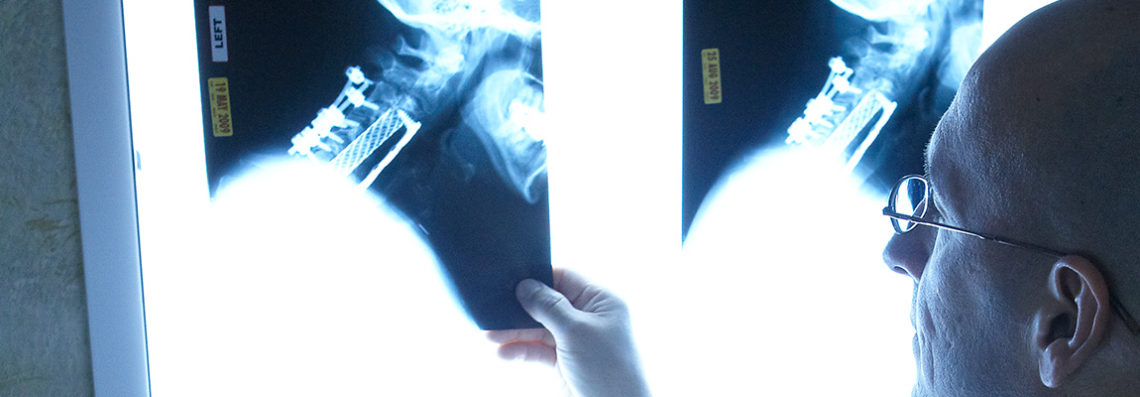 Neck Pain Keystone Spine And Pain Management Center Wyomissing 